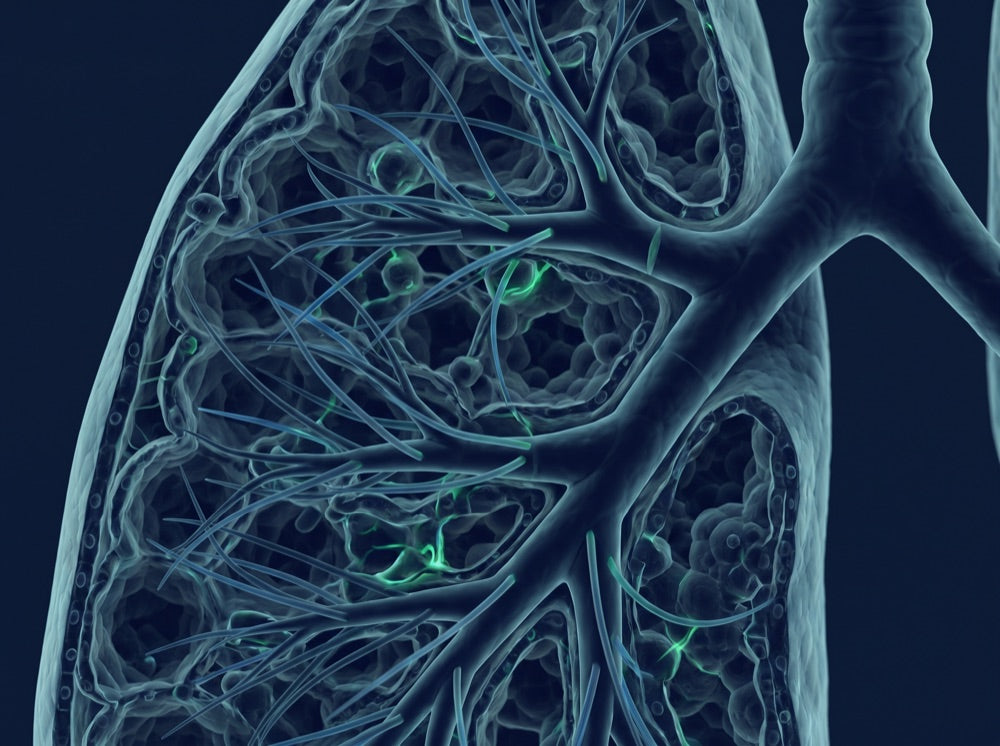 Lung tissue